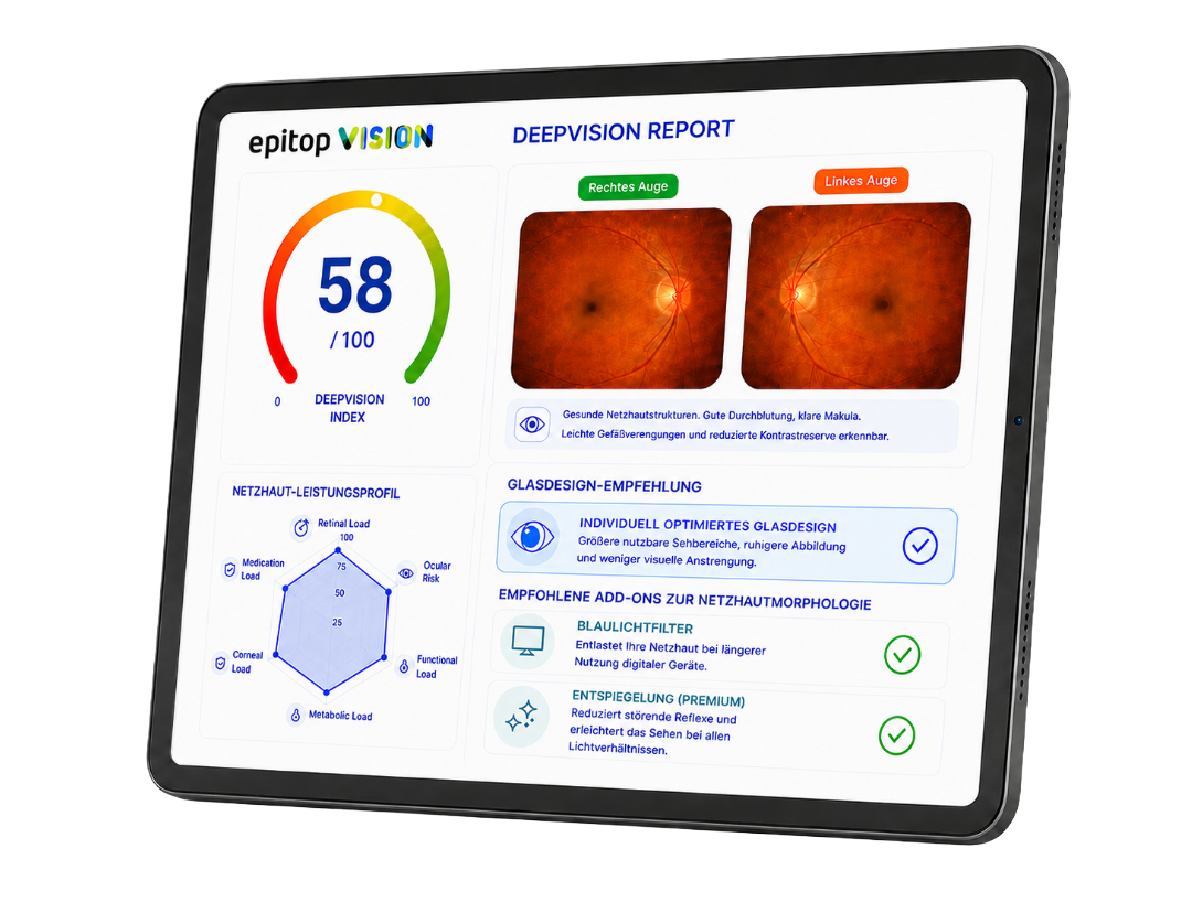 DeepVISION Simplifiziert Skizze08 1