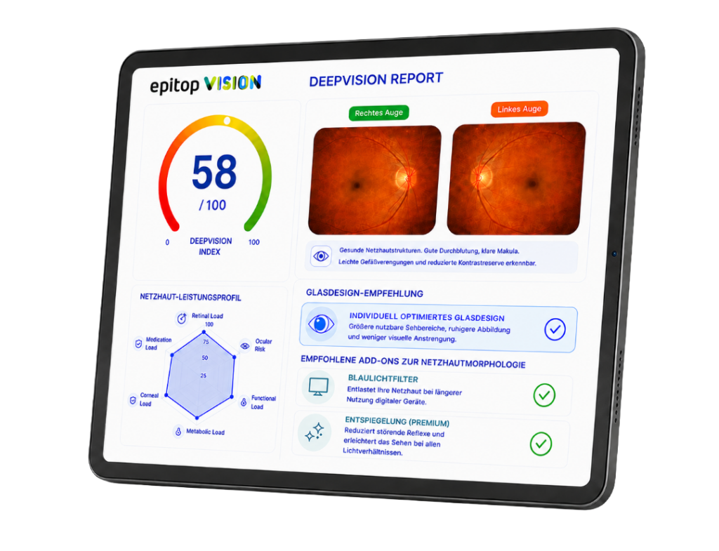DeepVISION Simplifiziert Skizze08